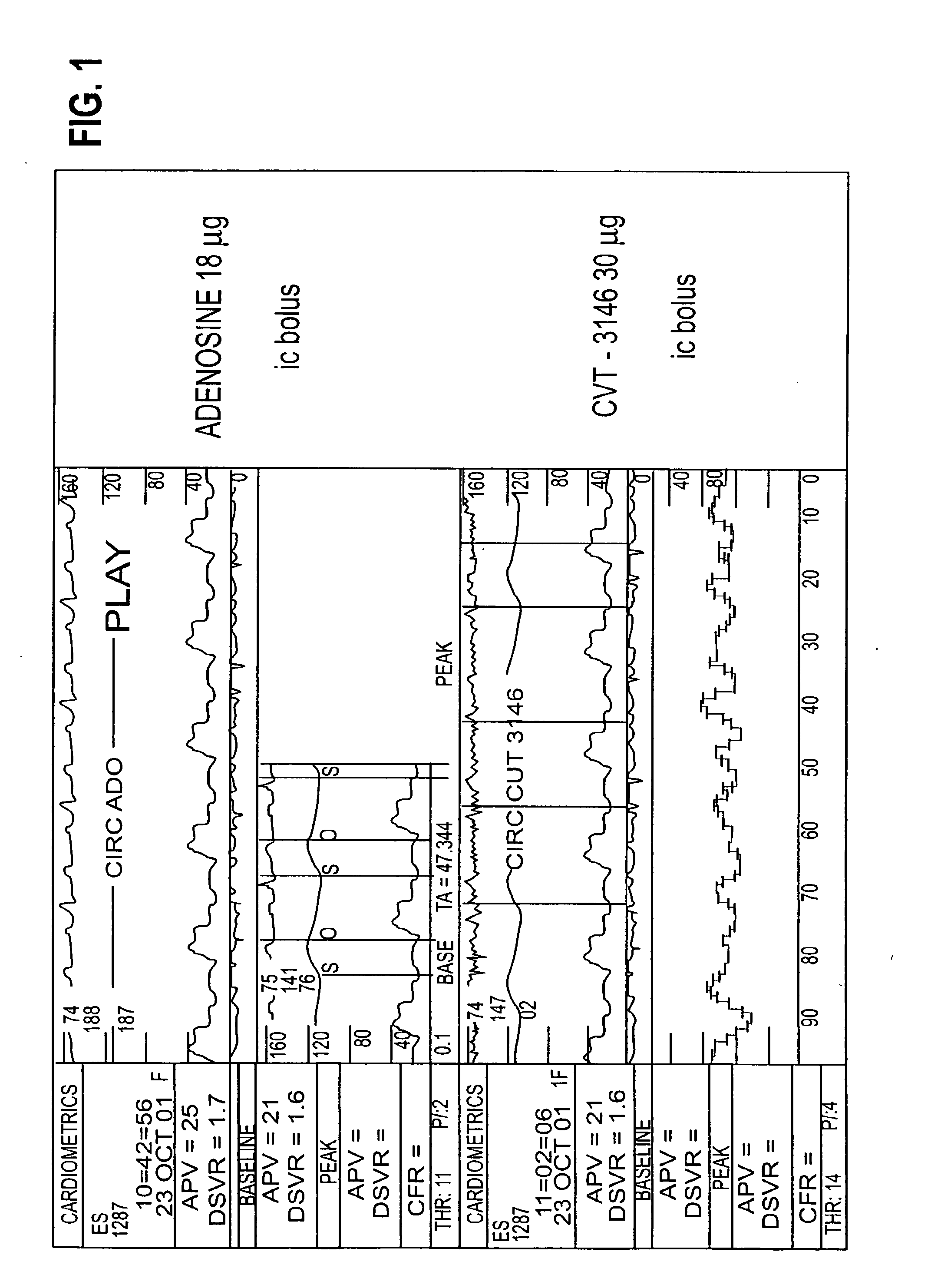 Myocardial perfusion imaging methods and compositions