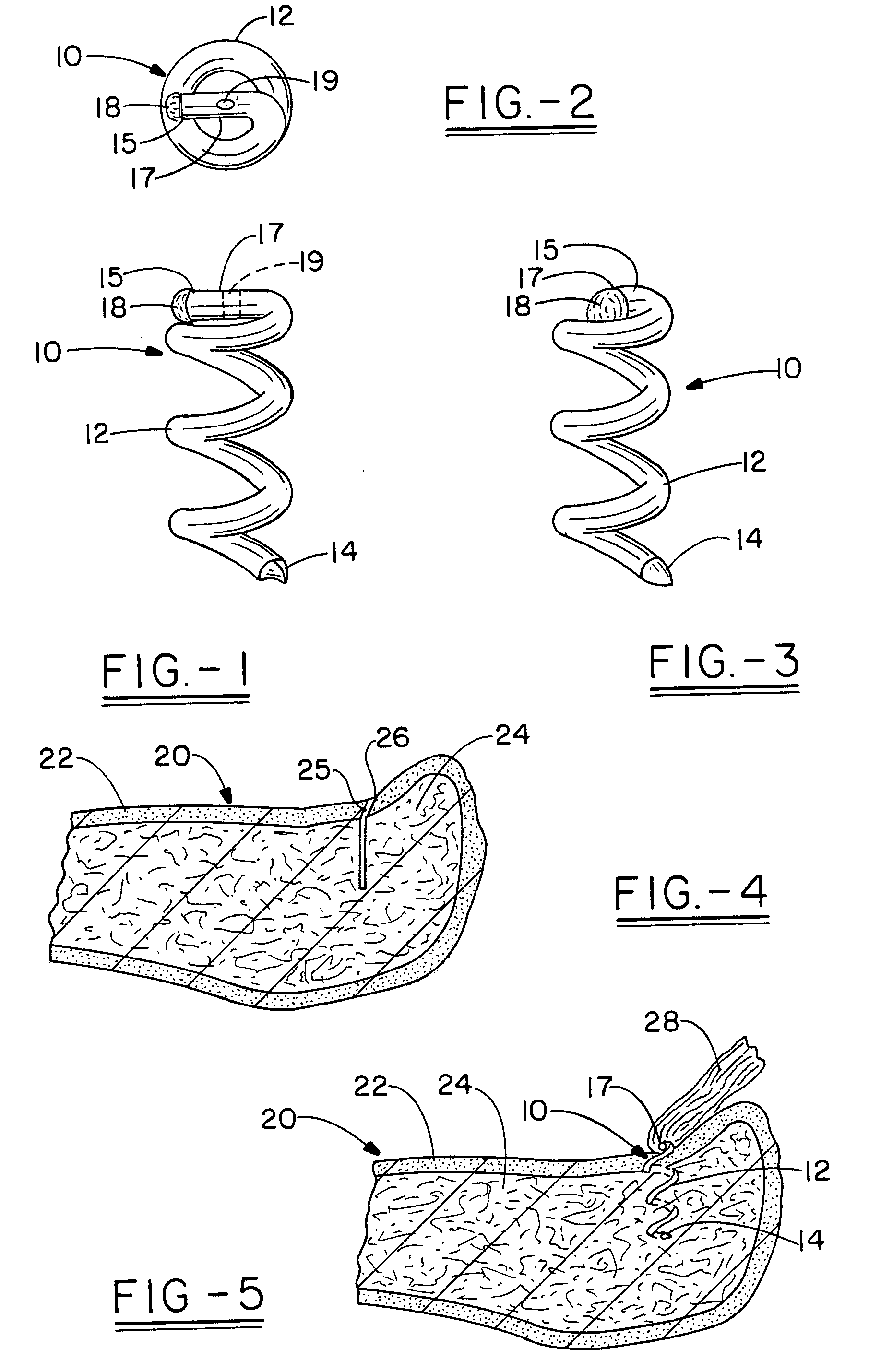 Open helical organic tissue anchor having recessible head and method of making the organic tissue anchor