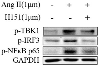 Application of STING inhibitor in preparation of anti-filtration channel conjunctival cicatrization treatment medicine