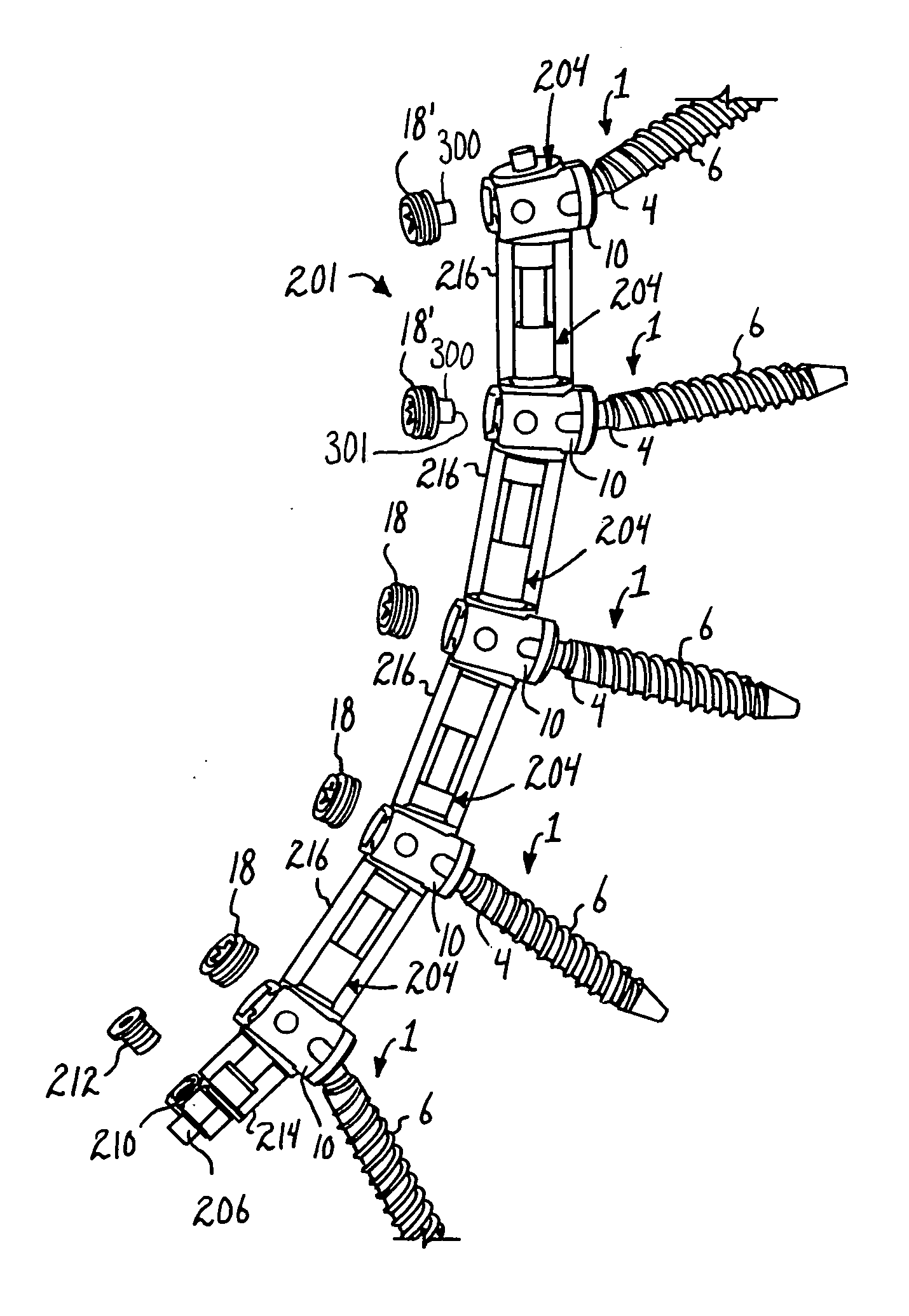 Spinal connecting members with radiused rigid sleeves and tensioned cords