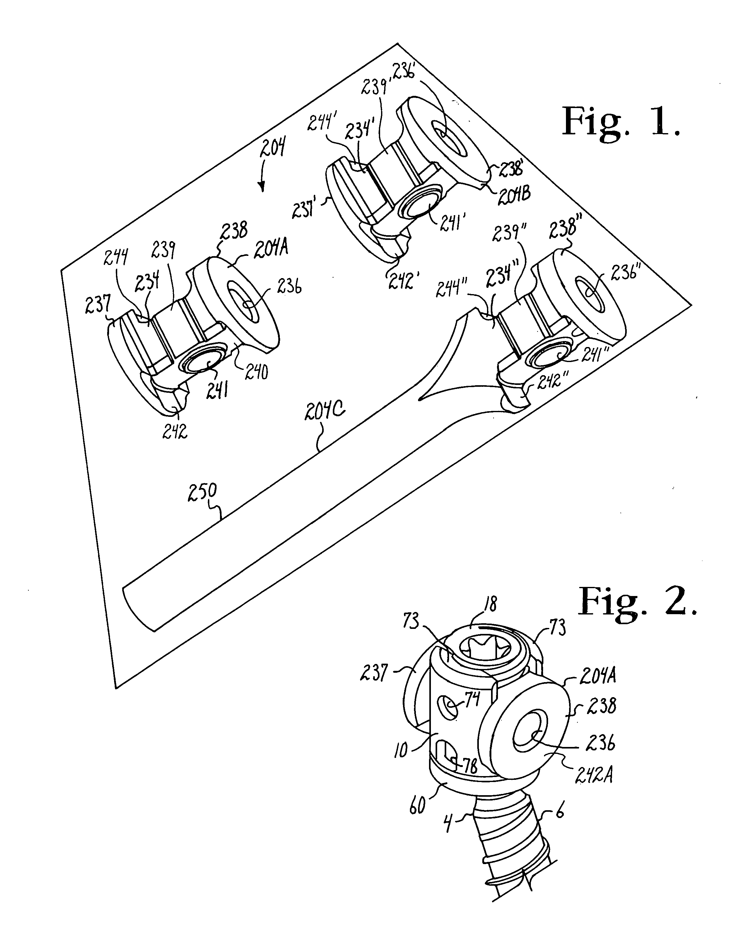 Spinal connecting members with radiused rigid sleeves and tensioned cords