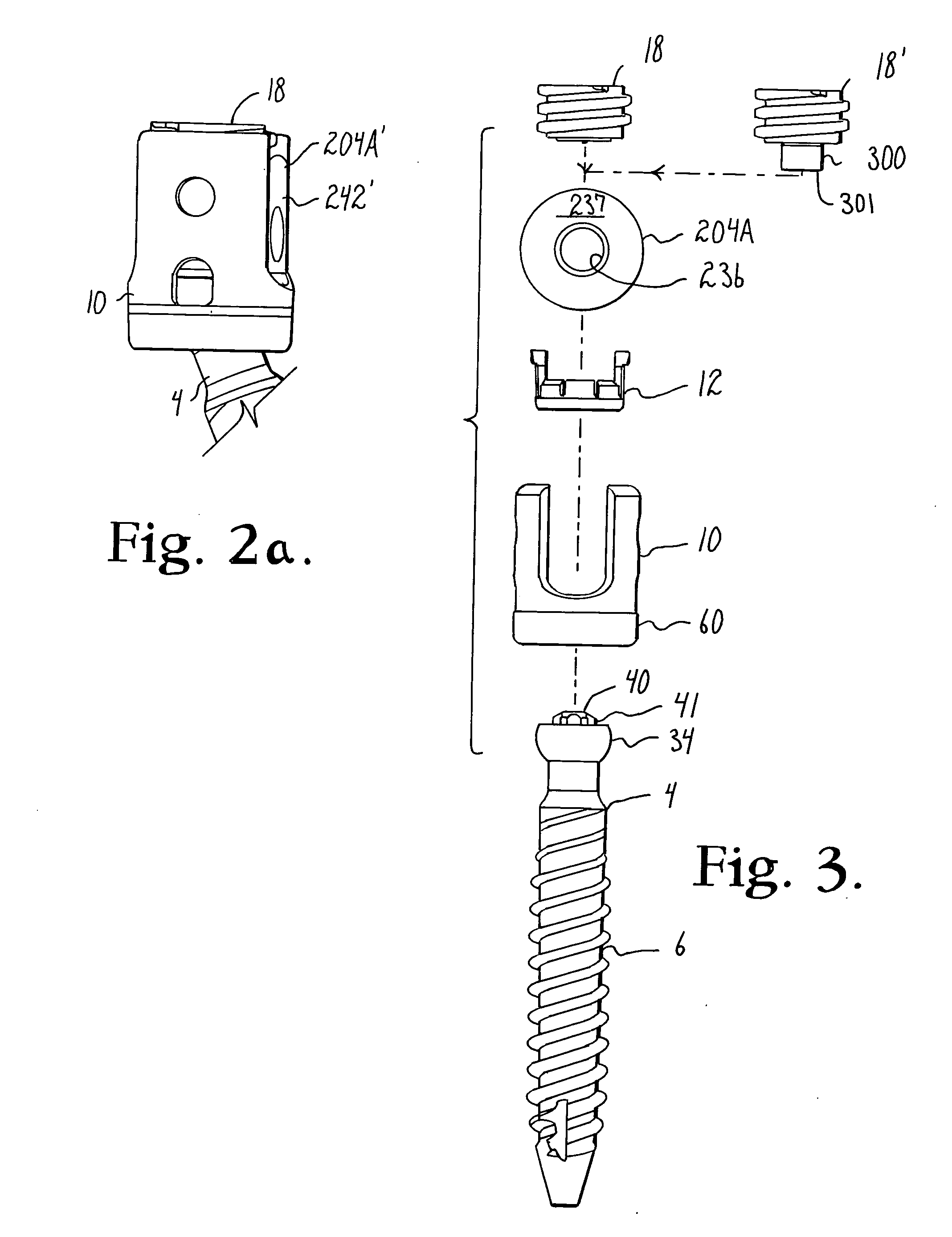 Spinal connecting members with radiused rigid sleeves and tensioned cords