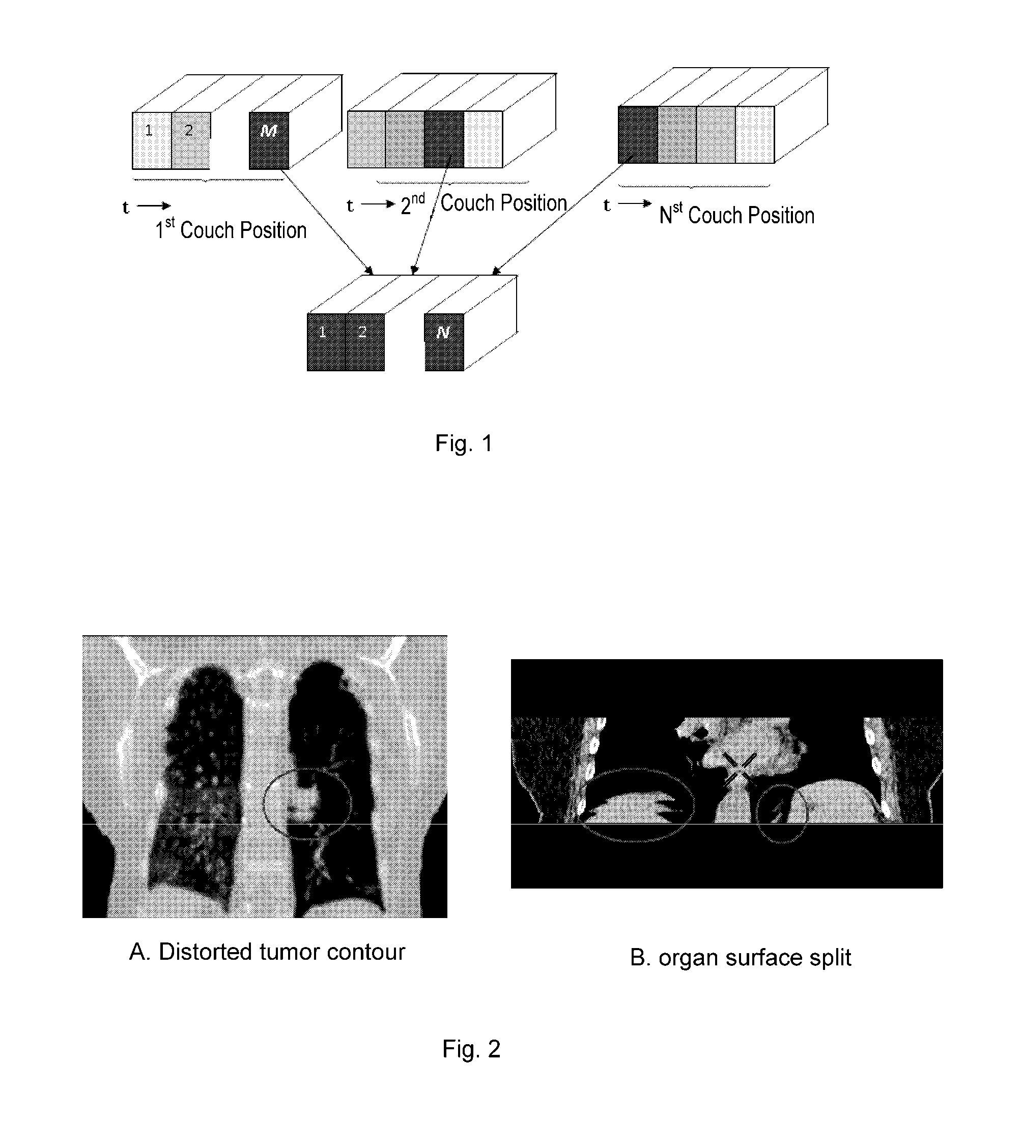 Method for sorting CT image slices and method for constructing 3D CT image