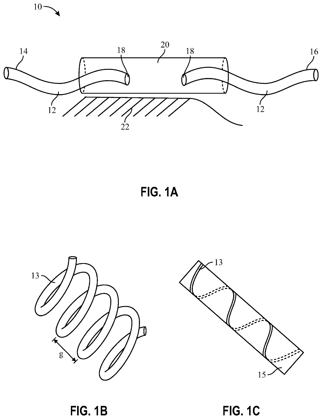 Brachytherapy stent configurations