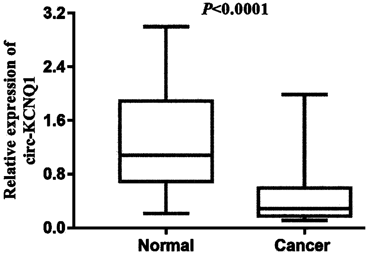 Primers and kit for detecting serum exosome circ-KCNQ1 and application of primers and kit in gastric cancer with liver metastasis