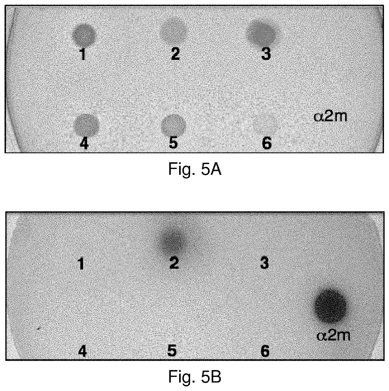 Topical and orally administered protease inhibitors and bacterial vectors for the treatment of disorders and methods of treatment