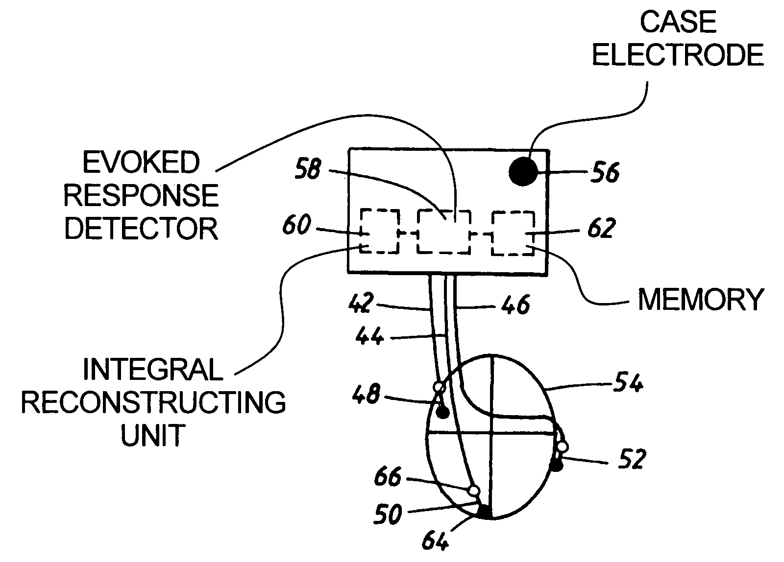 Multi-chamber pacing system