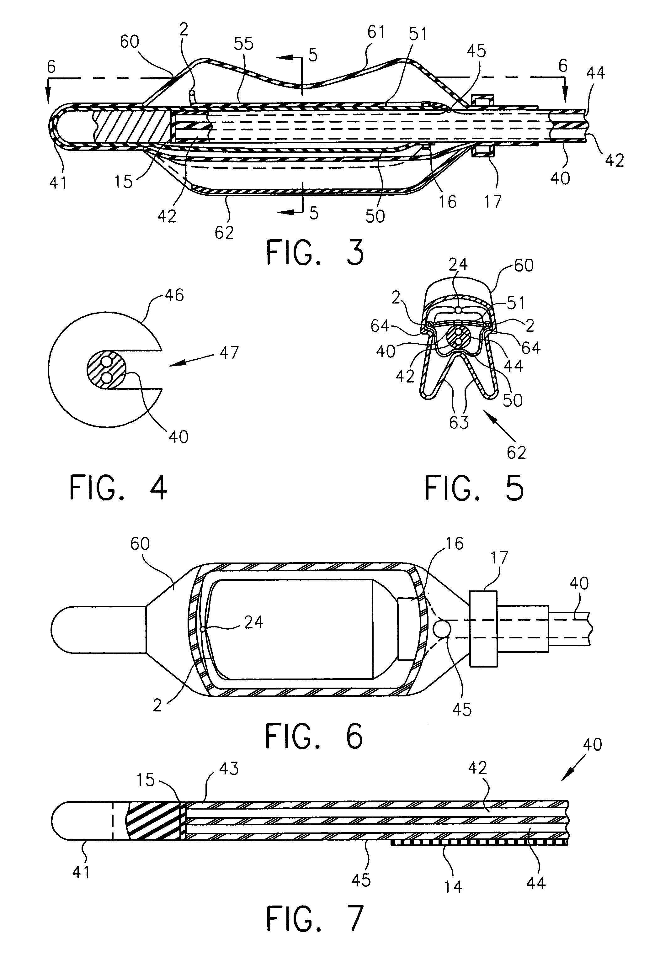 System and method of obtaining images and spectra of intracavity structures using 3.0 Tesla magnetic resonance systems