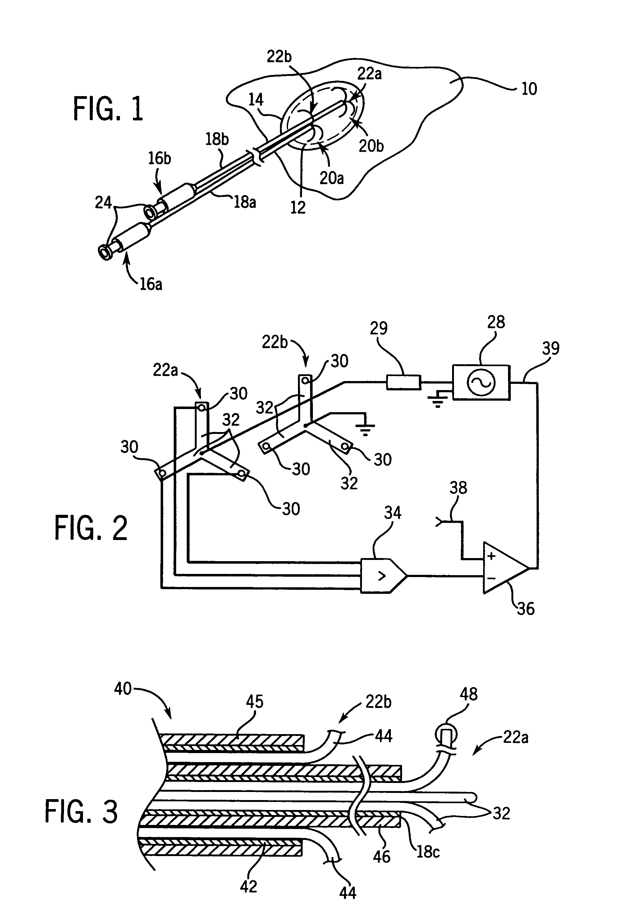 Radiofrequency ablation system using multiple prong probes