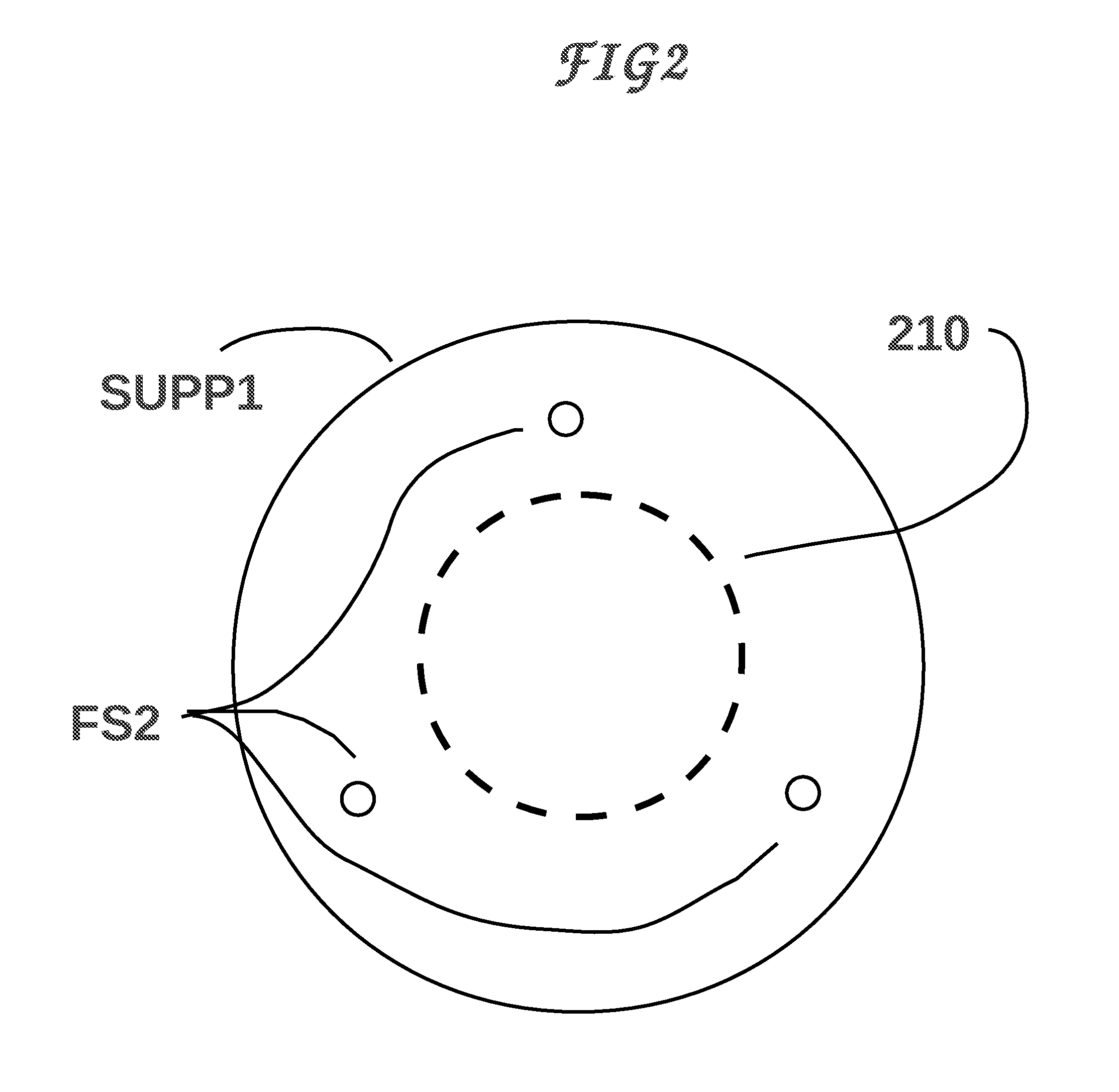 Device and means for adjusting the position of DBS brain and other neural and muscular implants
