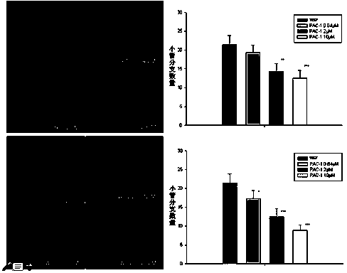 Application of oxadiazole piperazine compounds in preparing anti-angiogenesis drug