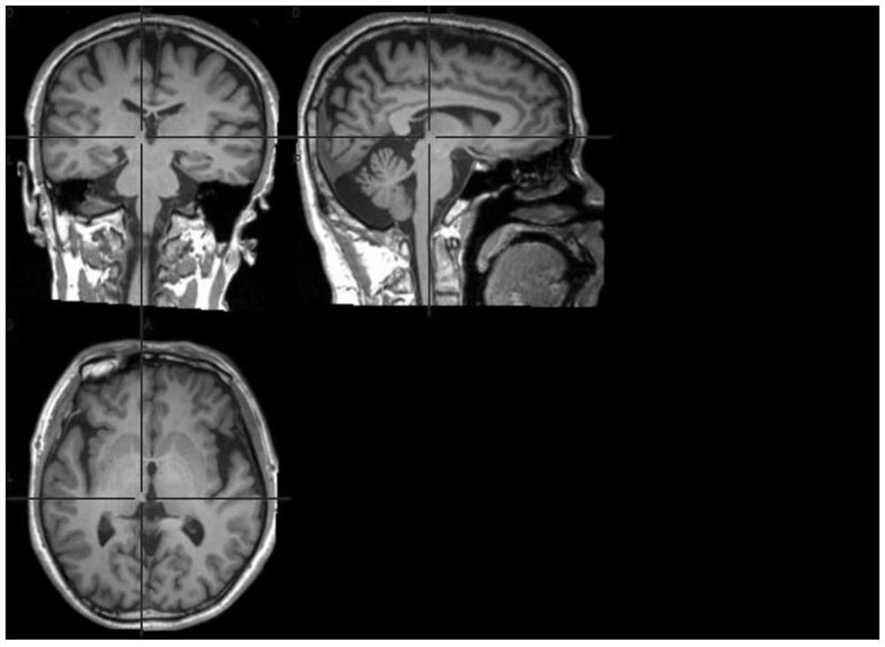 A kind of localization method of neural regulation target area