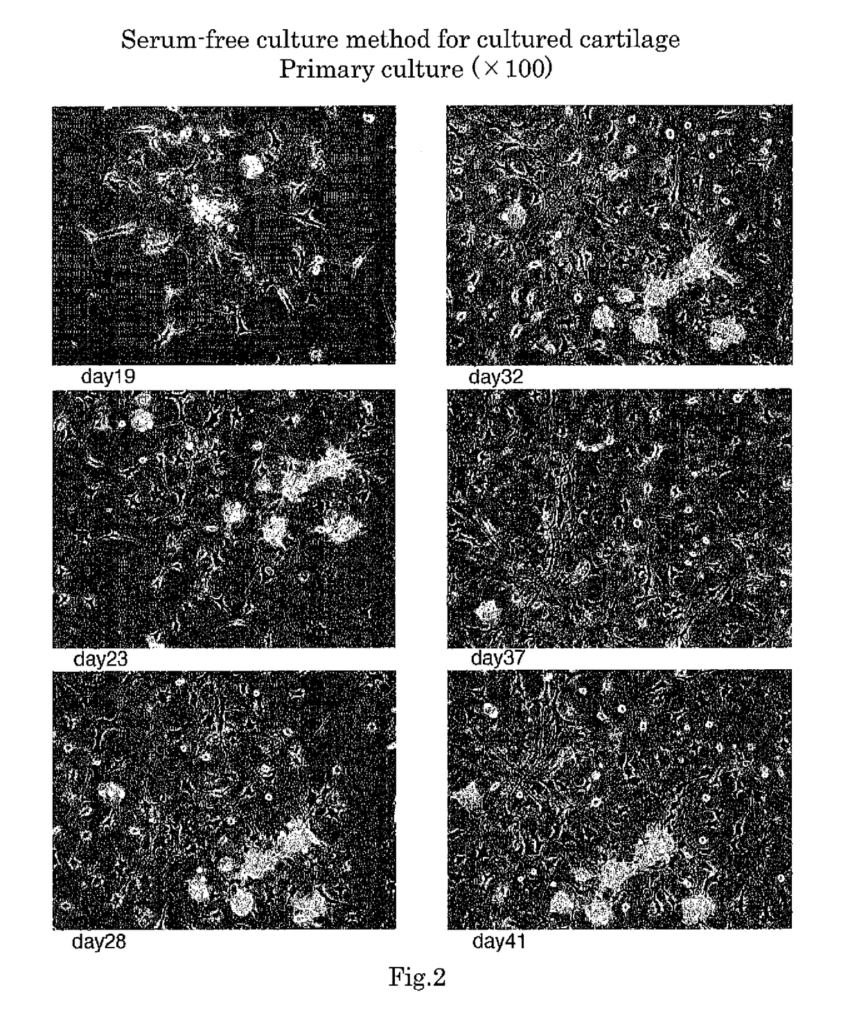 Method for serum-free culture of chondrocytes and serum-free culture medium