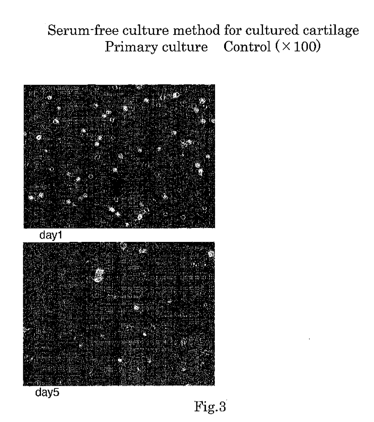 Method for serum-free culture of chondrocytes and serum-free culture medium