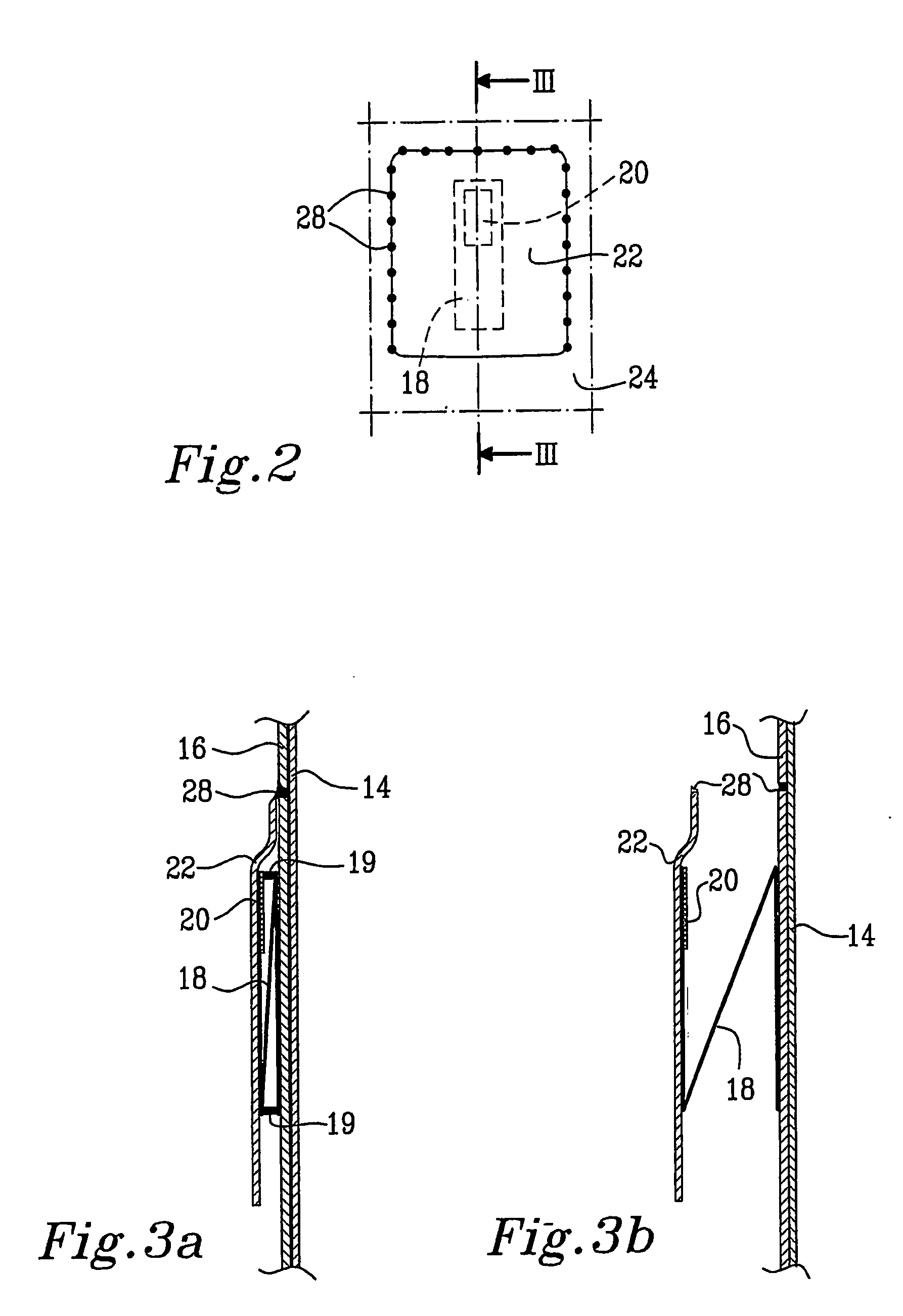 Absorbent article having disposal fastening means