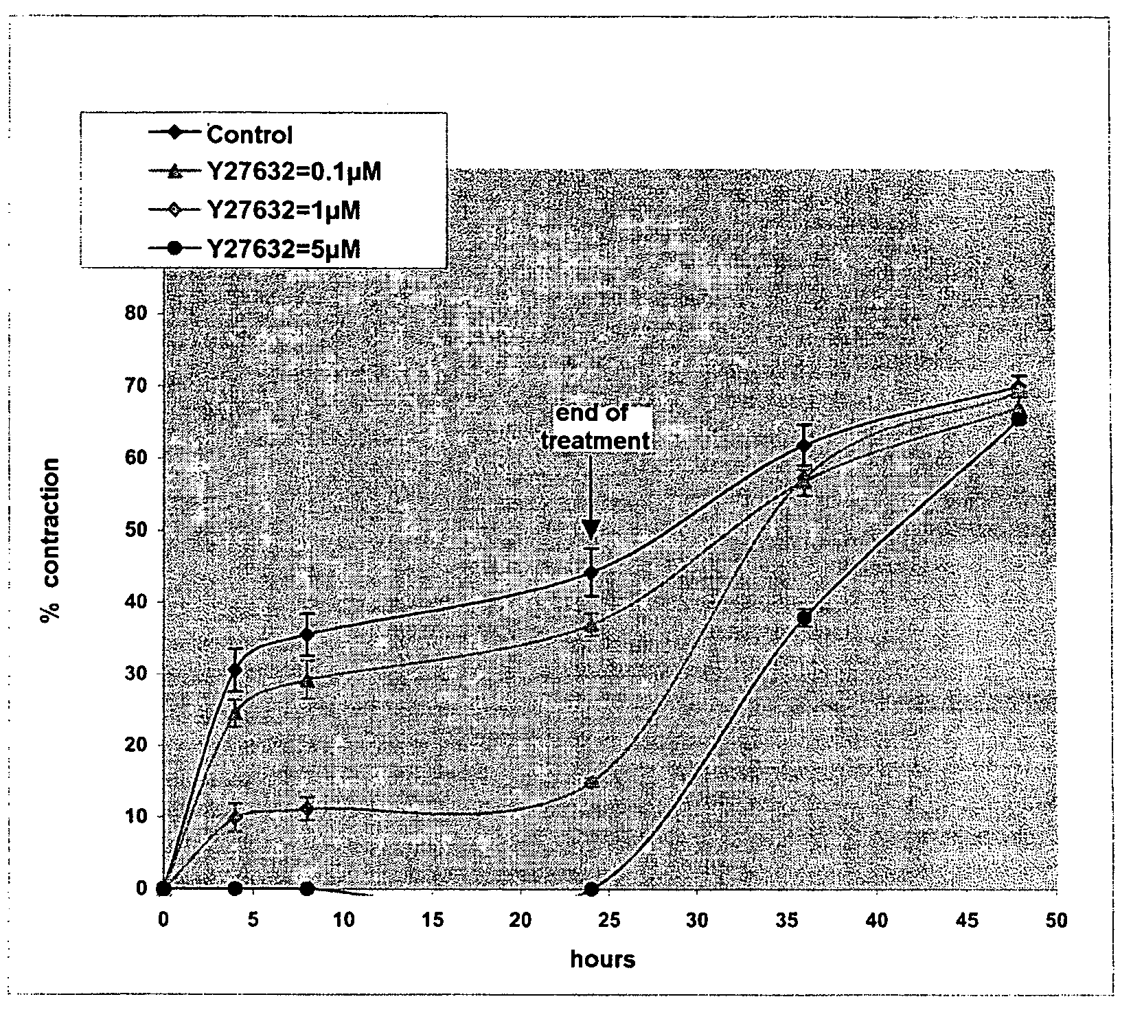 Inhibitors of RhoA kinase production/activation for relaxing the features of and/or for decontracting the skin