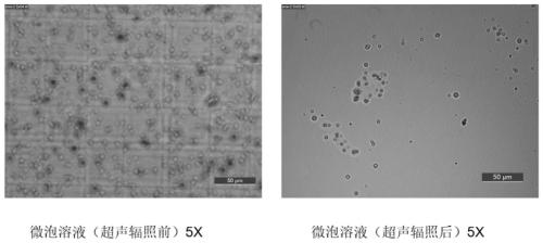 Application of microbubble-combined ultrasound intervention in improving receptivity of thin-type endometrium