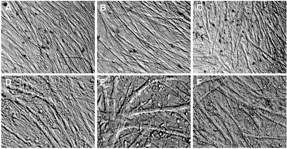 Preparation for enhancing differentiation capacity of chicken skeletal muscle myoblast and application thereof