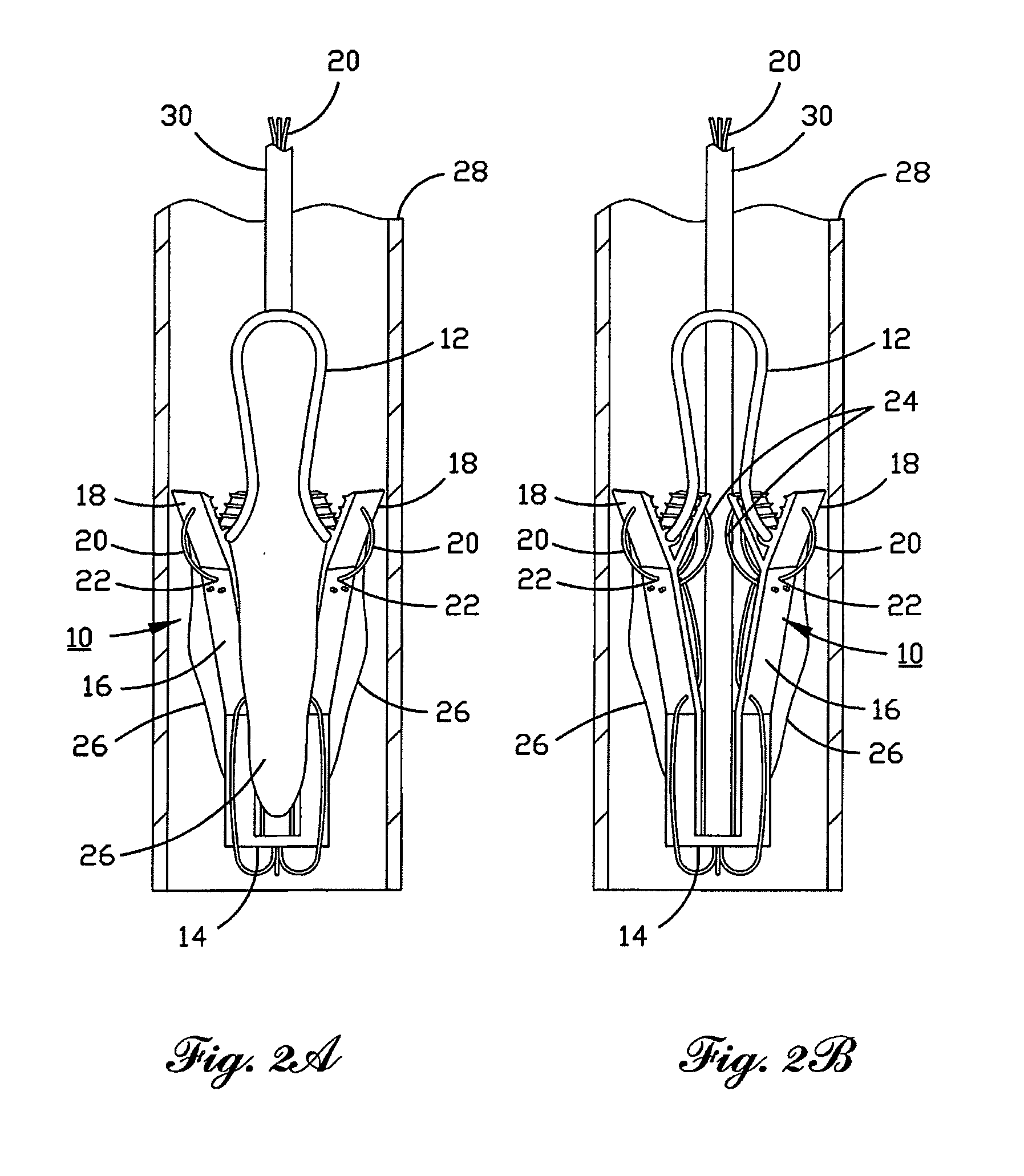 Percutaneous Heart Valve