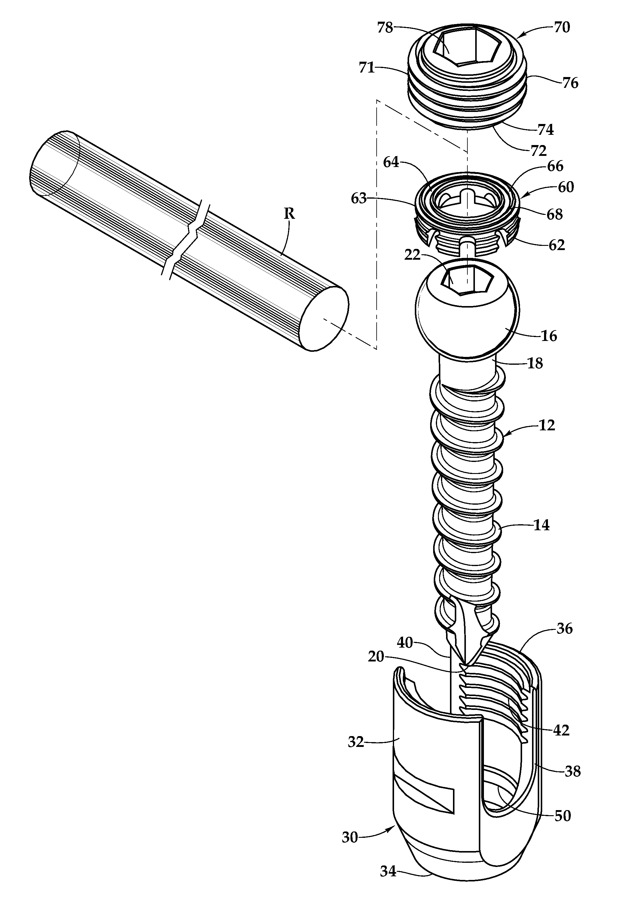 Pedicle screw fixation system and method for use of same