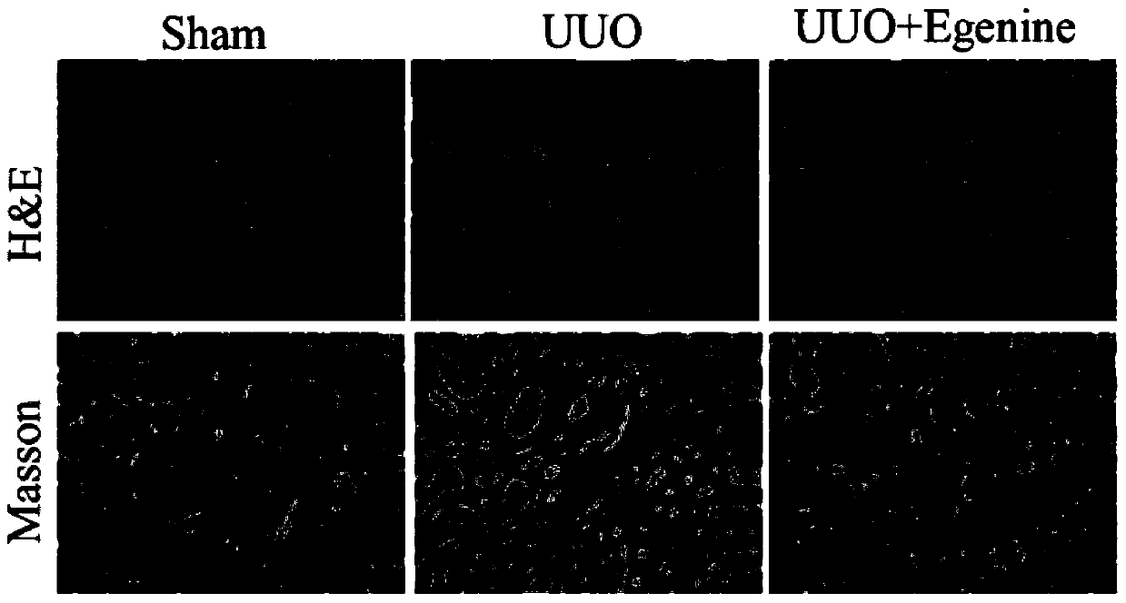 Application of natural compound Egenine in preparing medicament for resisting renal fibrosis