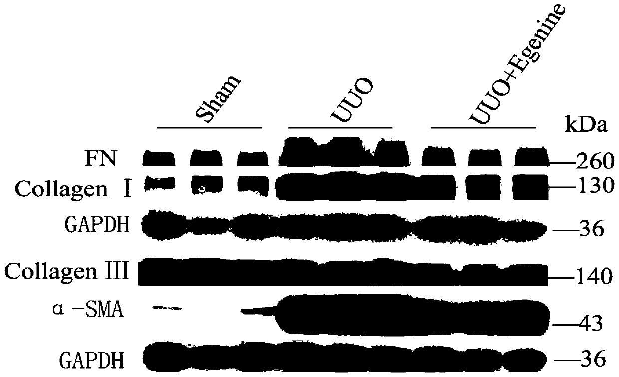 Application of natural compound Egenine in preparing medicament for resisting renal fibrosis