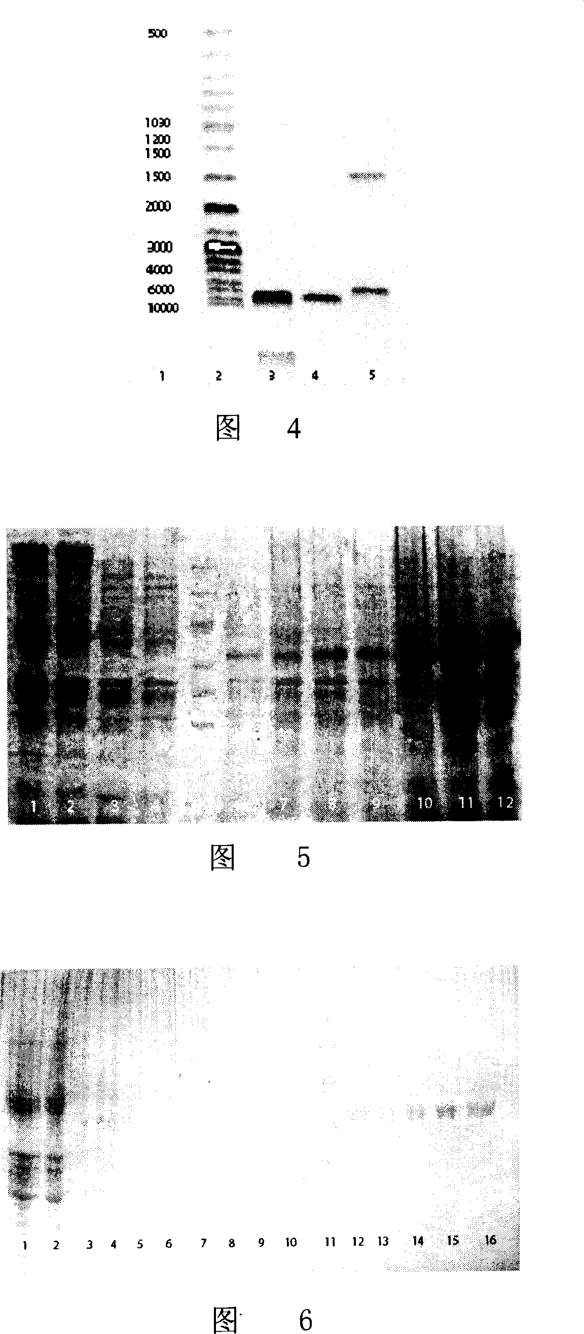 Gene expression product of extro-cellular domain amino end of human thyrotropin receptor, its preparing method and application in enzyme immune technology