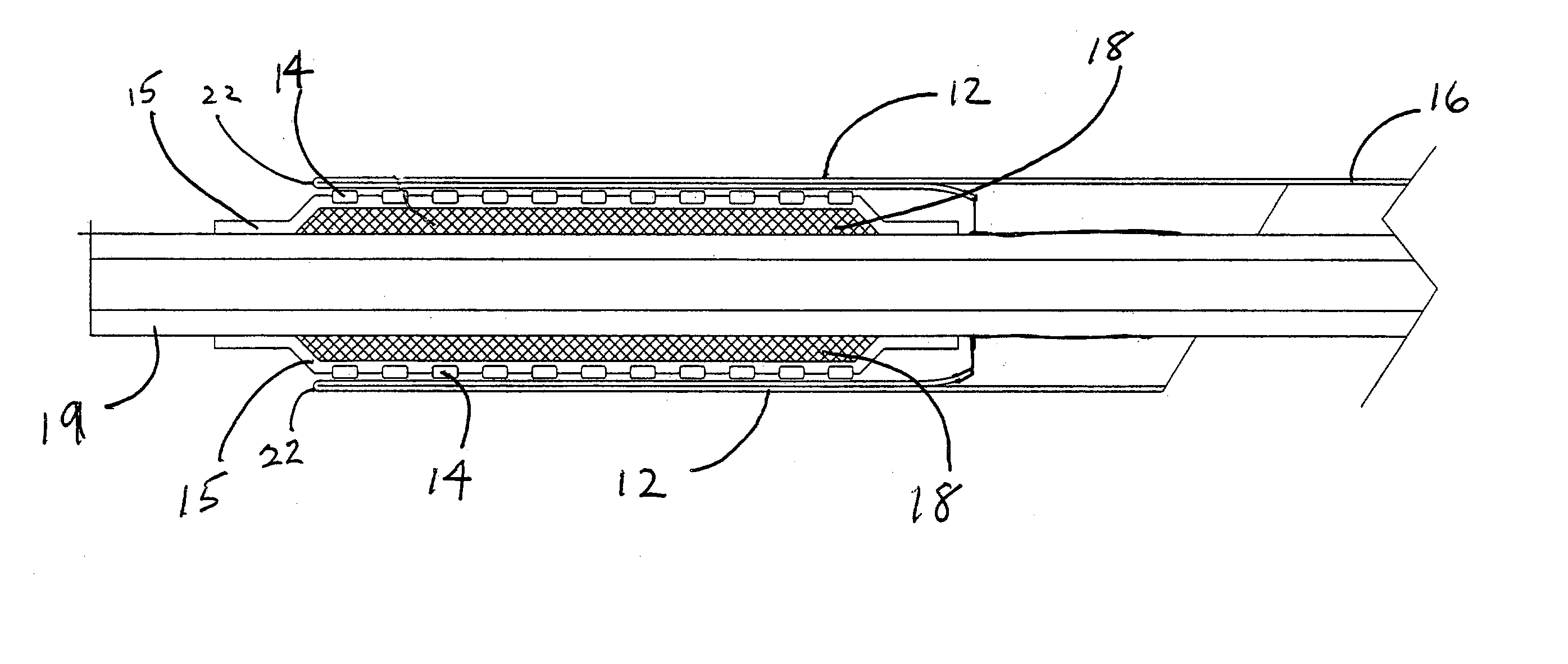Deployment system for an endoluminal device