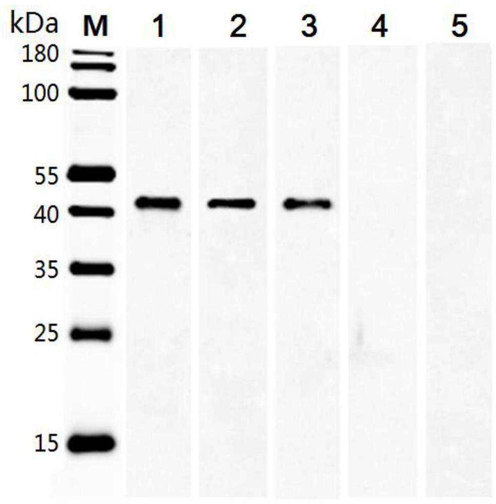 Schistosoma haematobium recombinant fusion protein ShSAP and application thereof to schistosomiasis immunodiagnosis