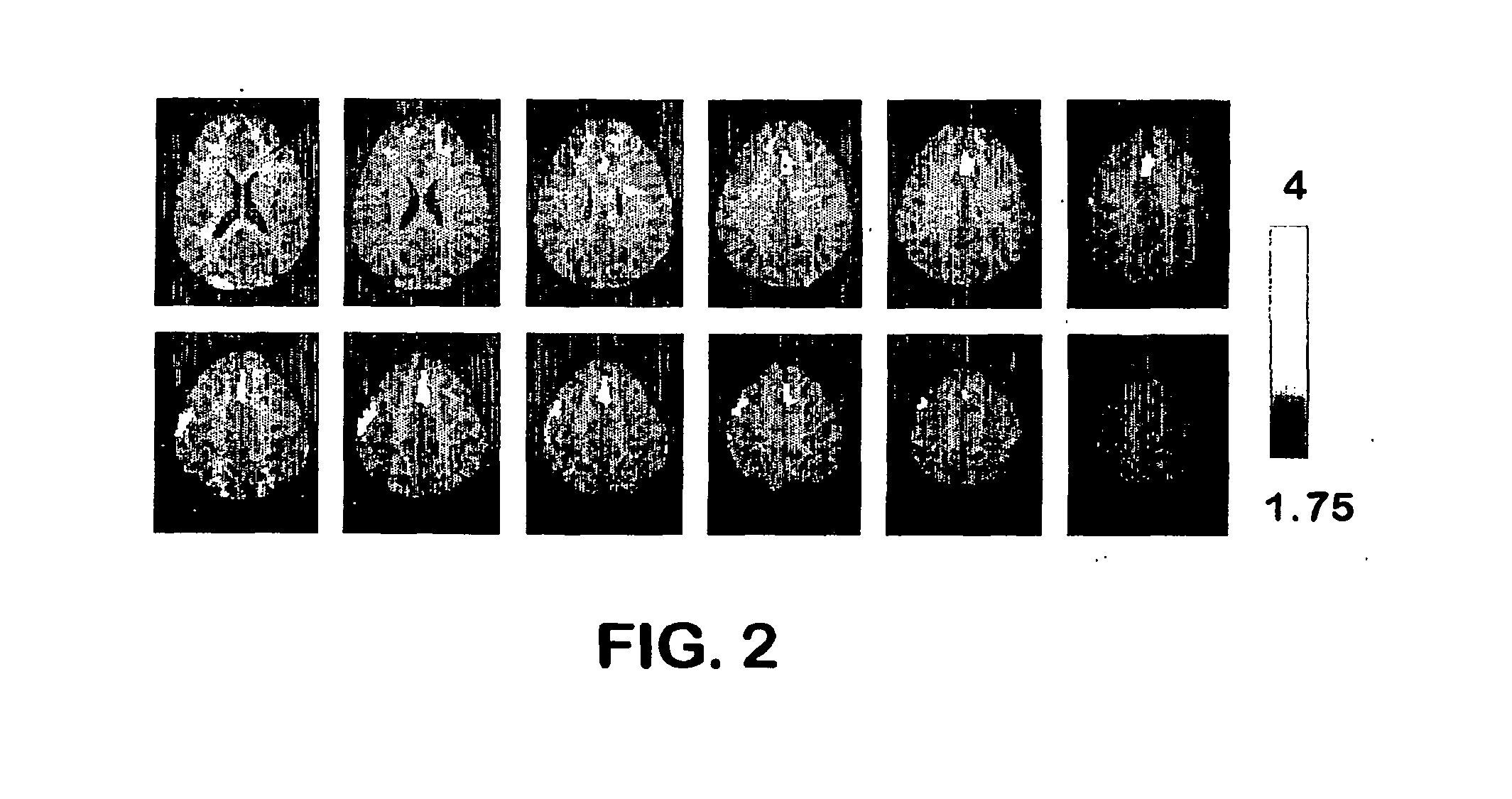 Functional brain imaging for detecting and assessing deception and concealed recognition, and cognitive/emotional response to information