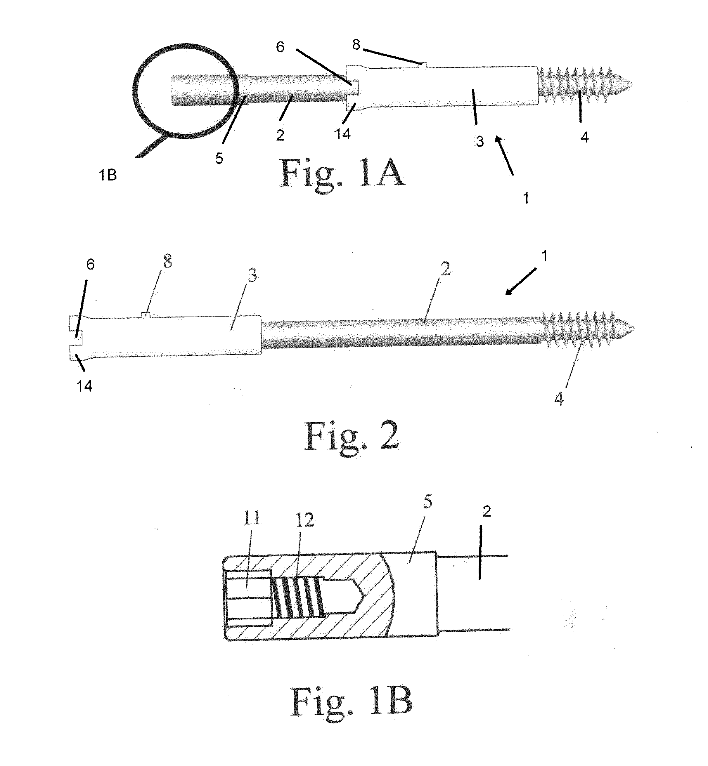 Method for connecting fractured bone