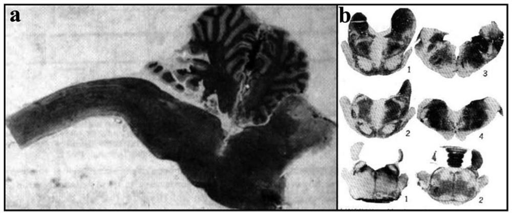 Experimental method for determining anatomo-functional delimitation of sublaterodorsal tegmental nucleus (SLD)