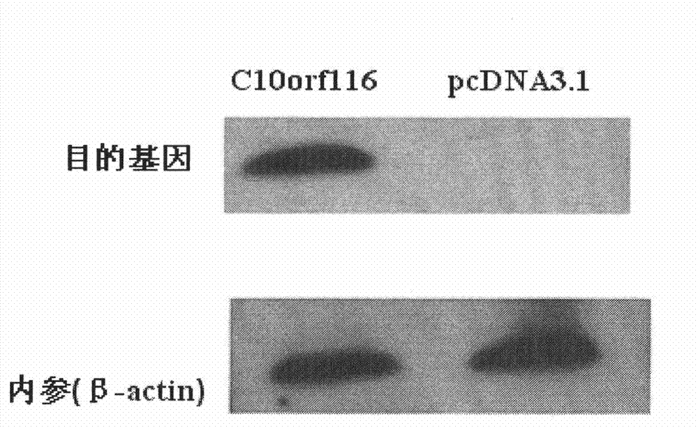 Application of C10orf116 genes in preparing medicament for improving insulin sensitivity of adipose tissue