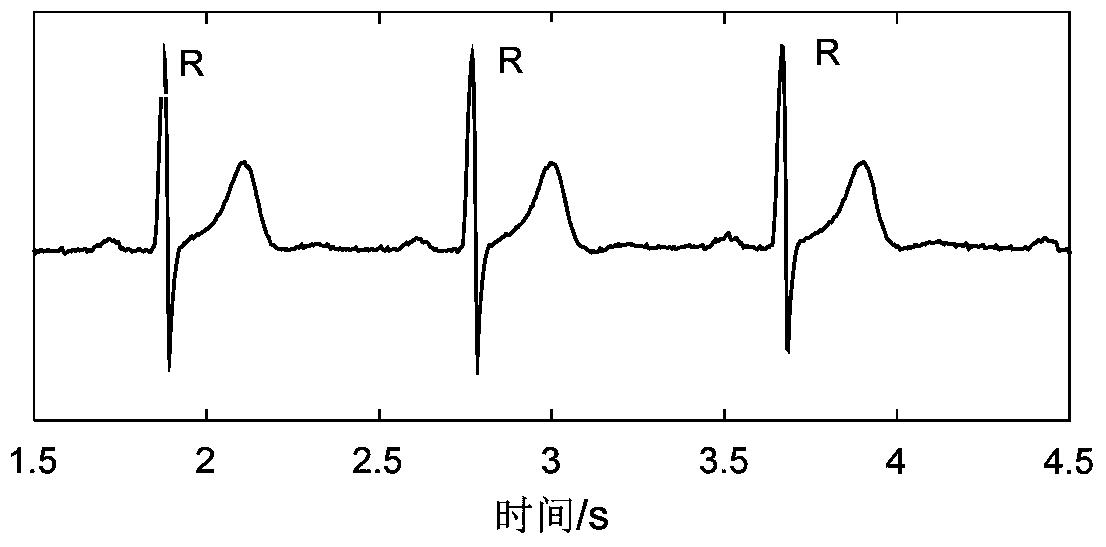 A Fast Identification Method of ECG Signal Based on Random Tree