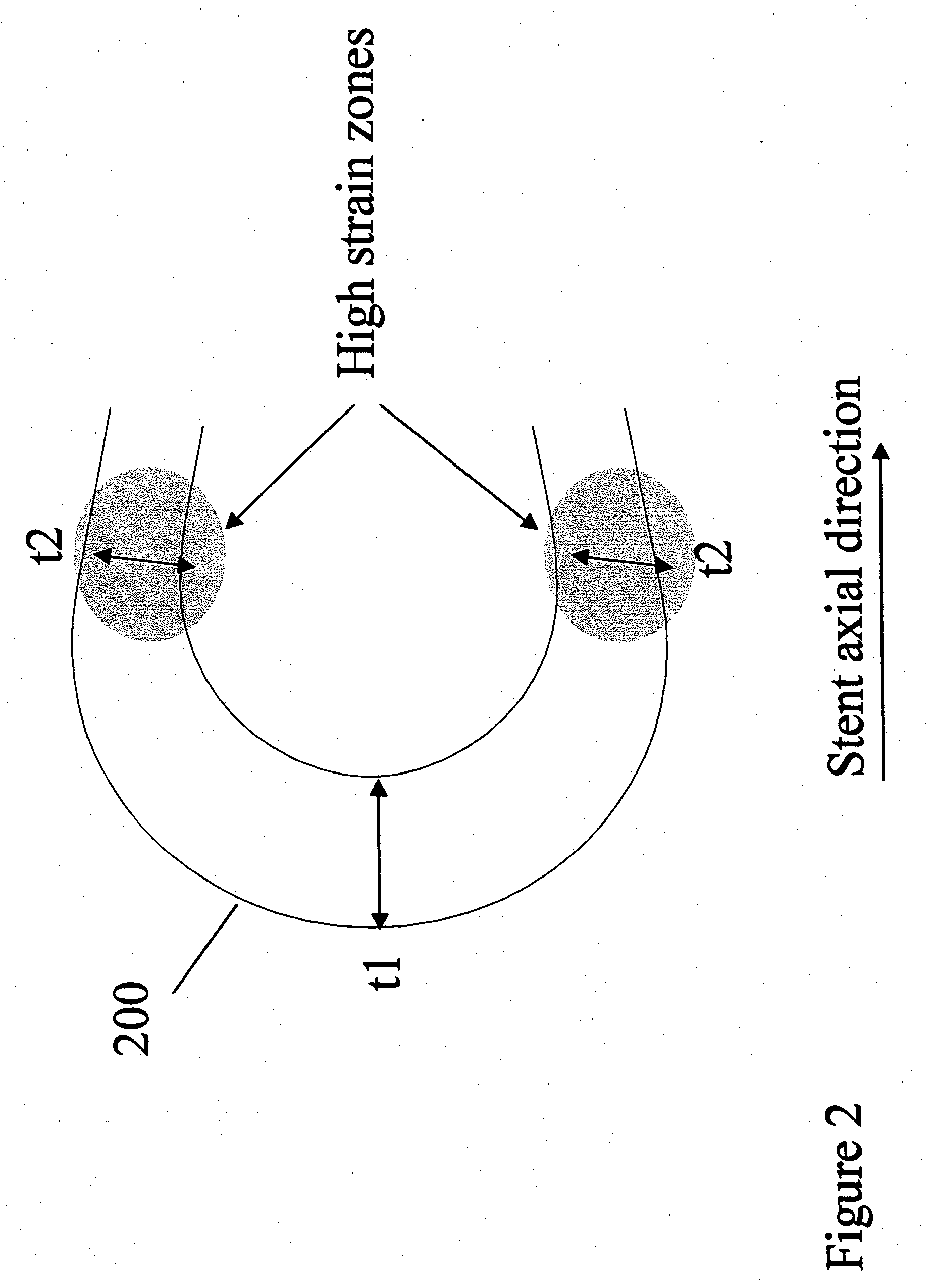 Polymeric stent having modified molecular structures in selected regions of the flexible connectors