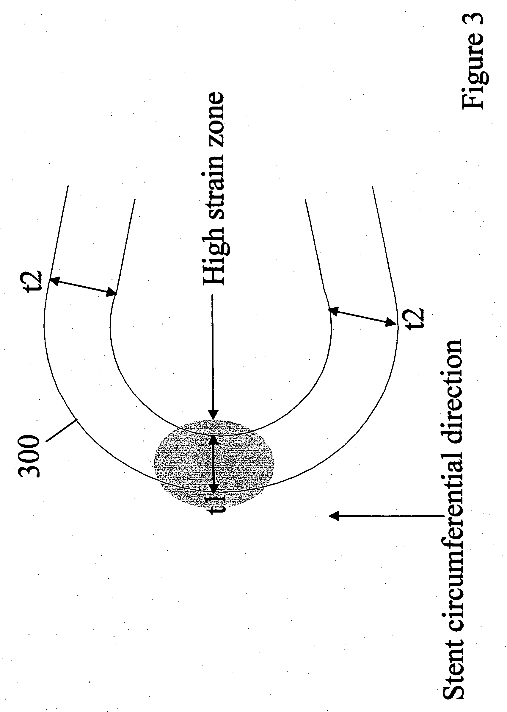 Polymeric stent having modified molecular structures in selected regions of the flexible connectors