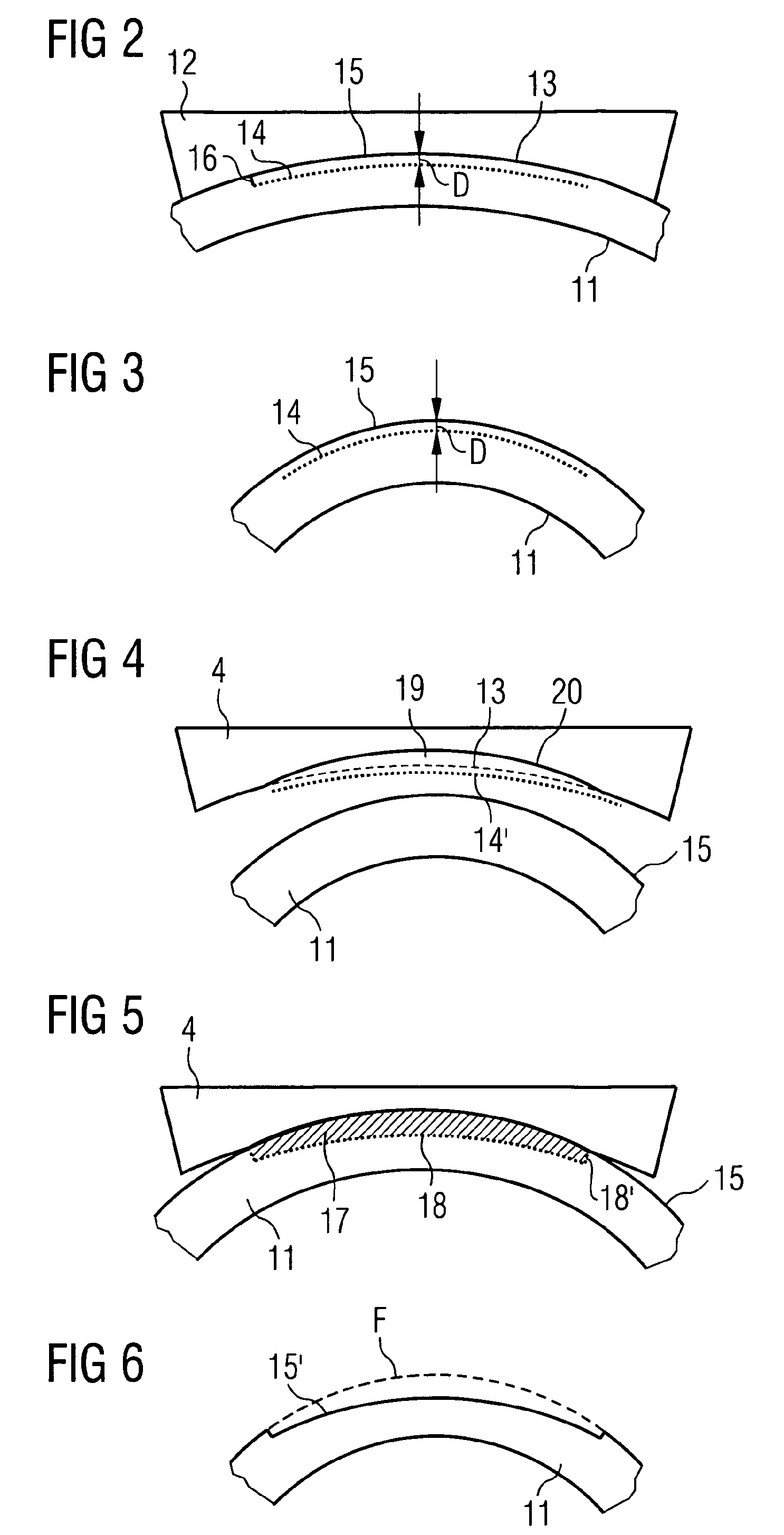 Apparatus for generating a correcting cut surface in the cornea of an eye so as to correct ametropia as well as a contact element for such apparatus