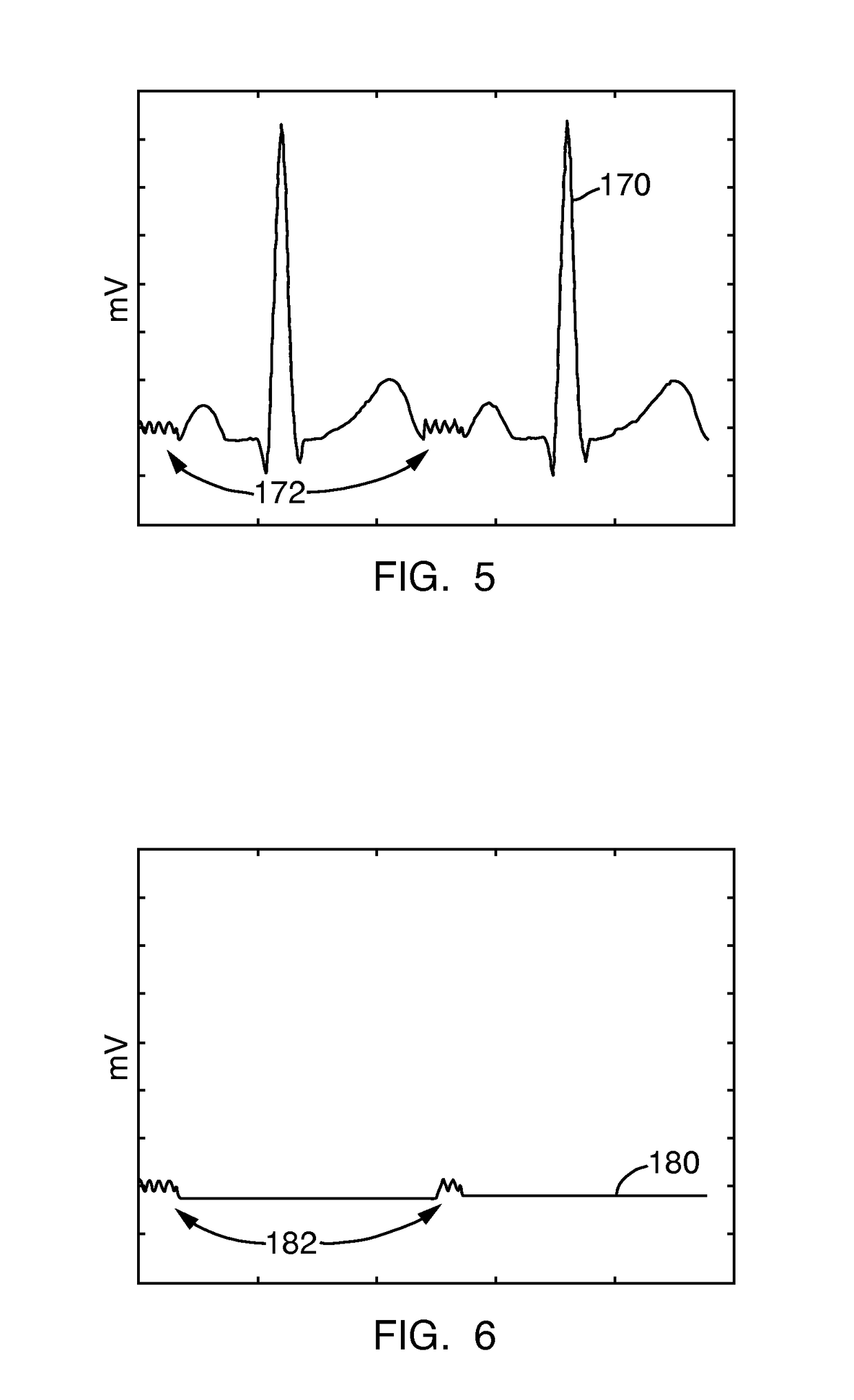 Method and system for analyzing noise in an electrophysiology study