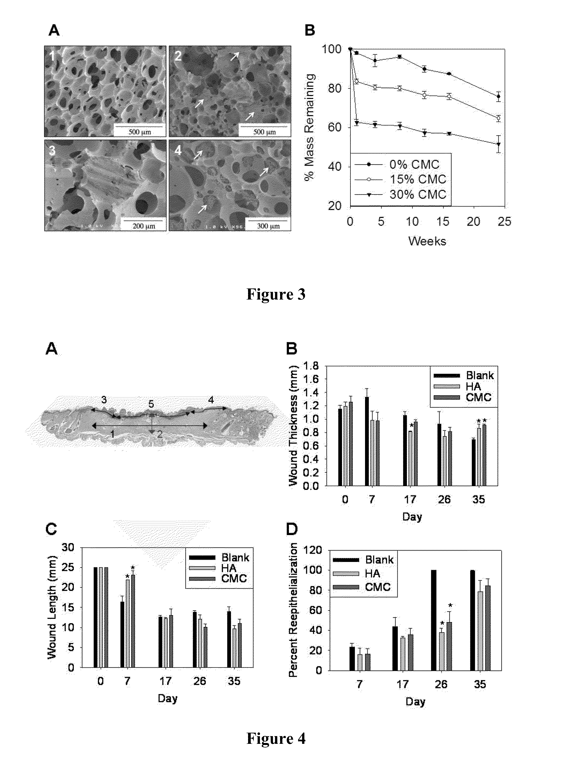 Polyurethane Composite for Wound Healing and Methods Thereof