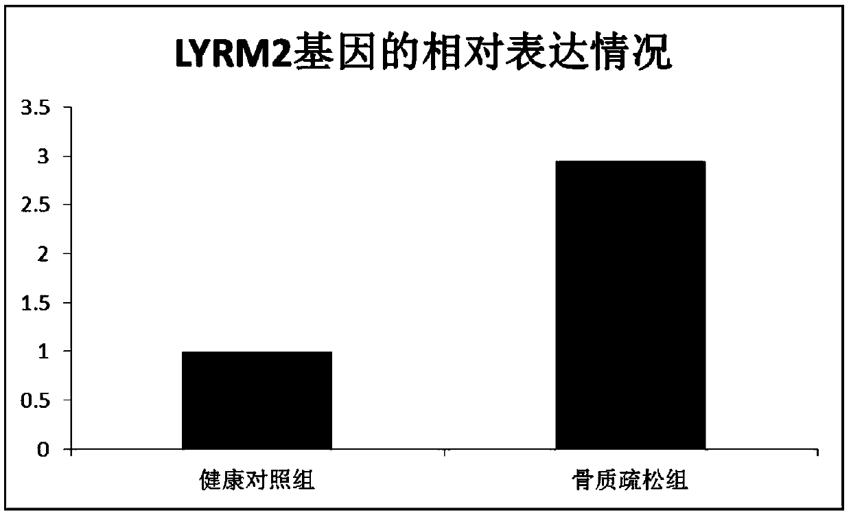 LYRM2 (LYR motif-containing 2) gene and new use of expression product thereof