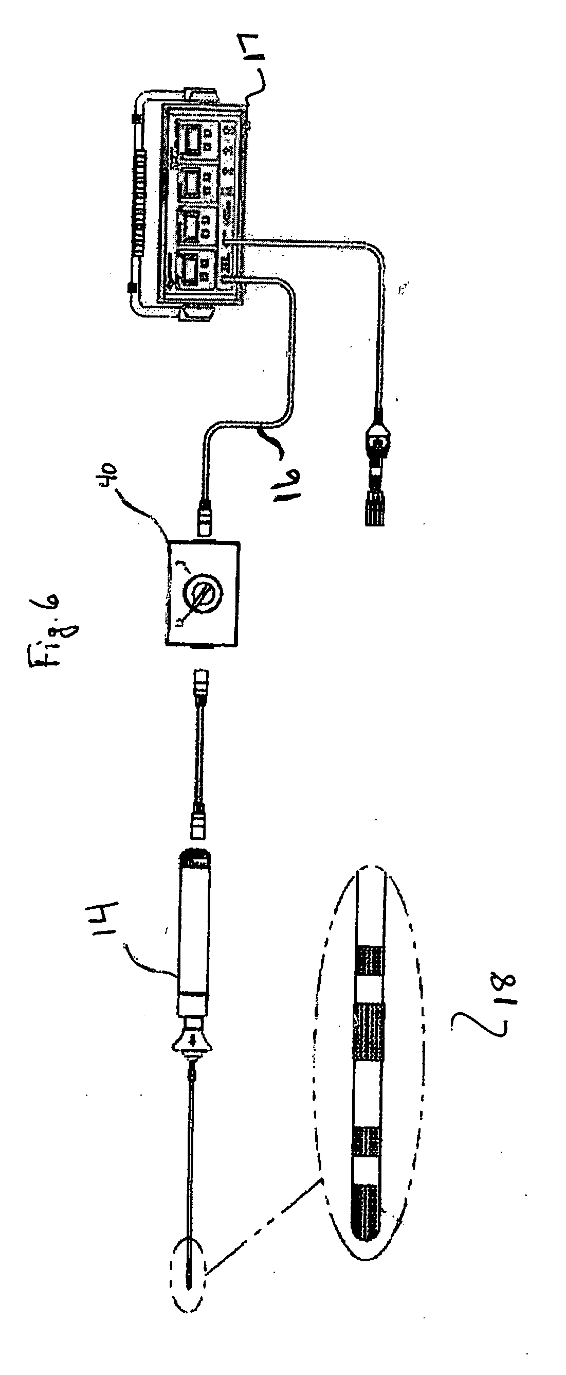 Catheter system and method of use thereof