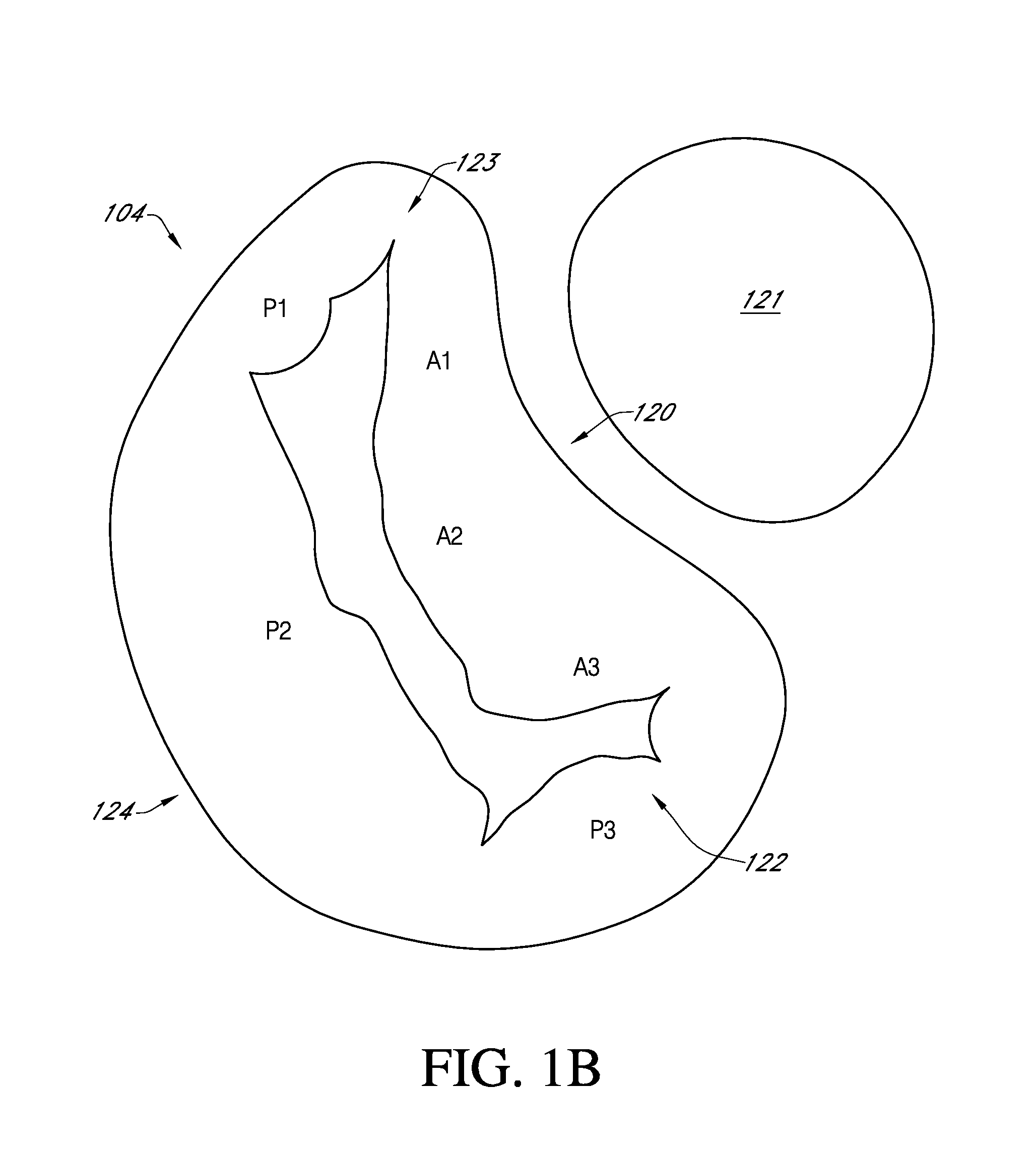 Prosthetic mitral valve with adjustable support