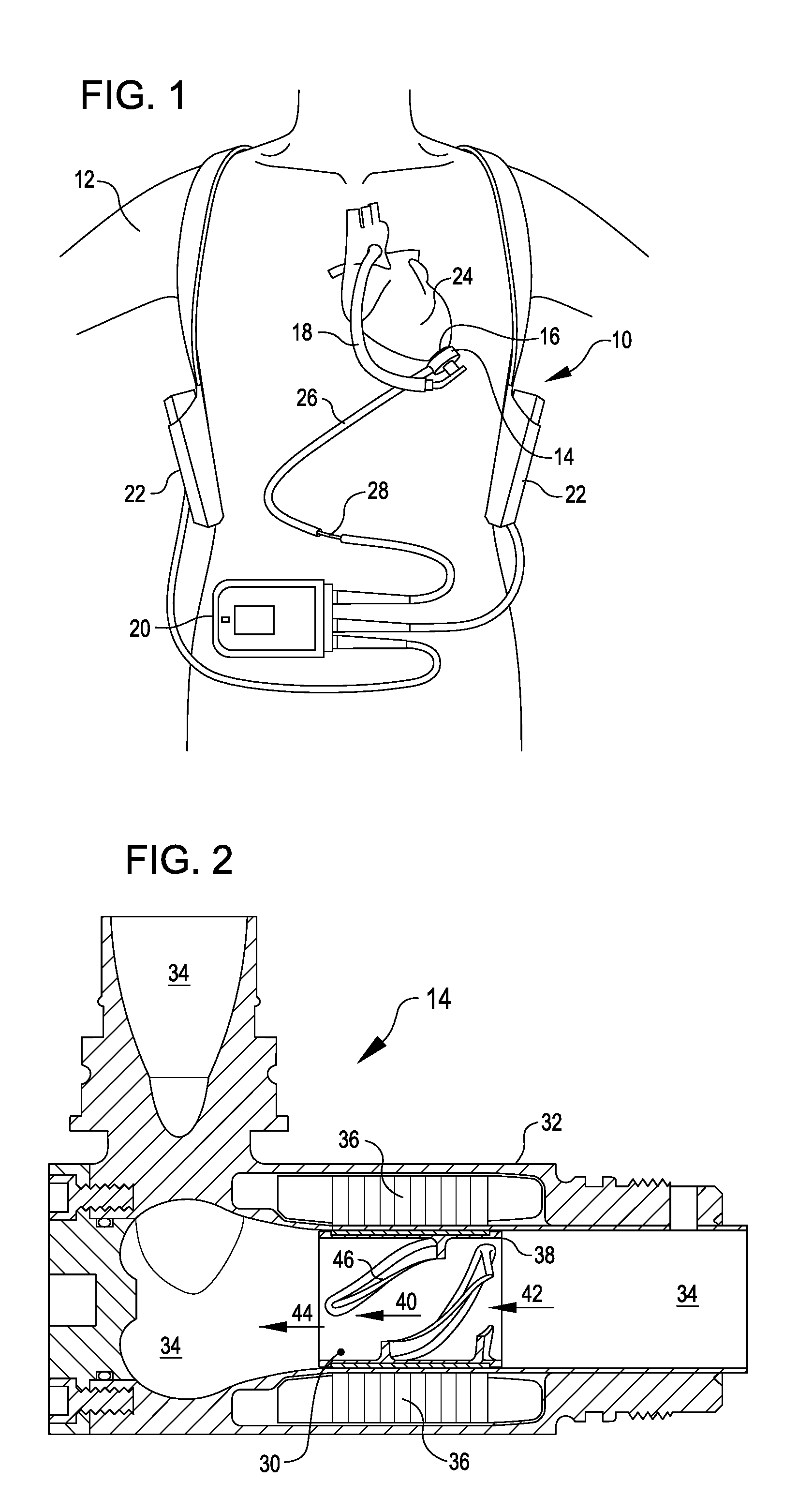 Ventricular assist devices having a hollow rotor and methods of use