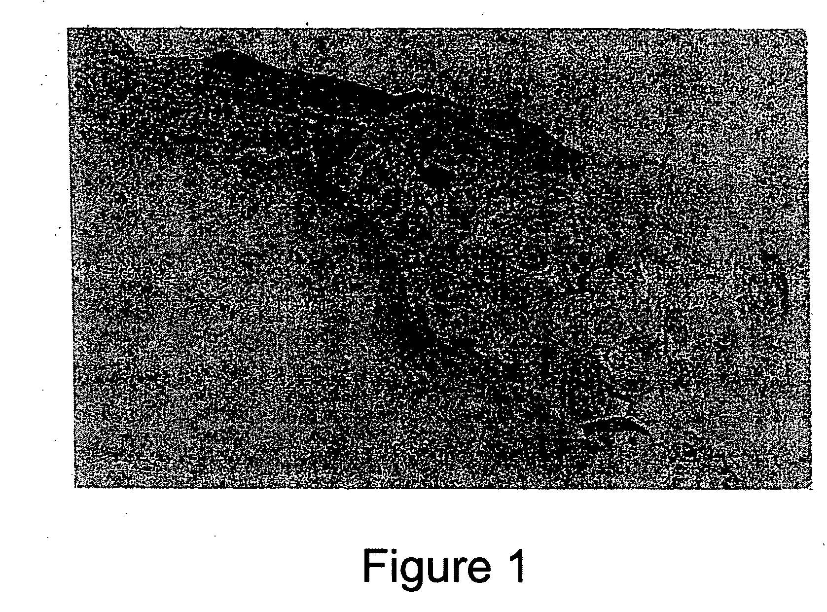 Tissue system with undifferentiated stem cells derived from corneal limbus