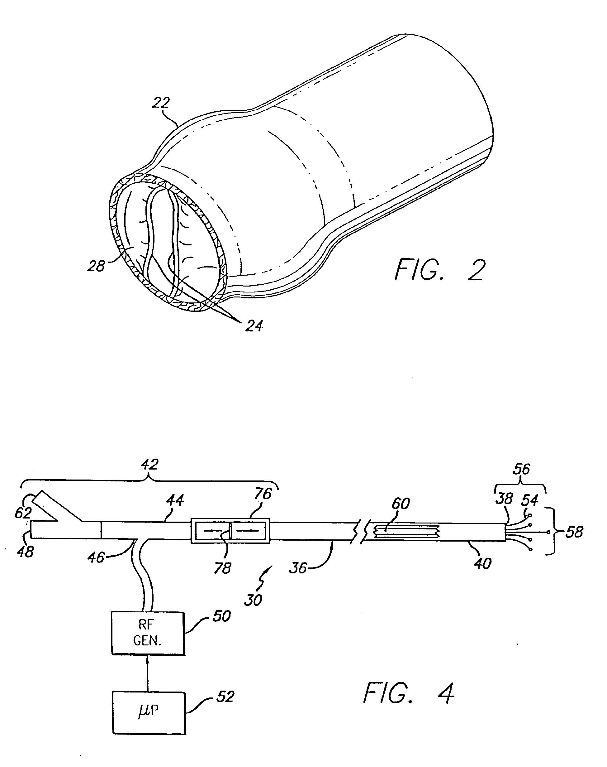 Method and apparatus for applying energy to biological tissue including the use of tumescent tissue compression