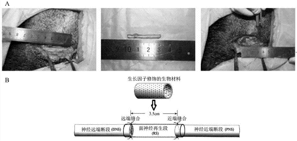 Collagen material for repairing peripheral nerve injury containing two factors and preparation method thereof