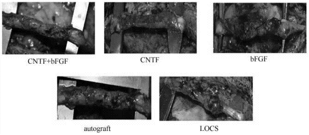 Collagen material for repairing peripheral nerve injury containing two factors and preparation method thereof