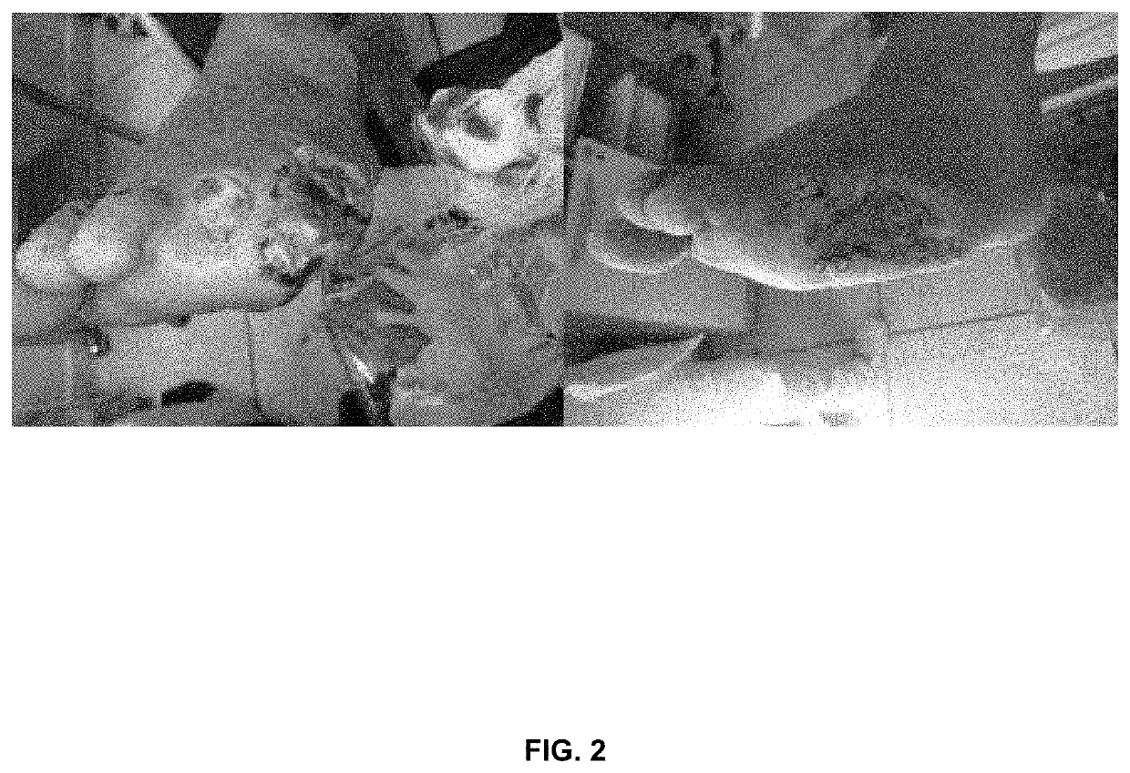 Topical semisolid composition containing an antimicrobial agent and pirfenidone for the treatment of chronic skin damage