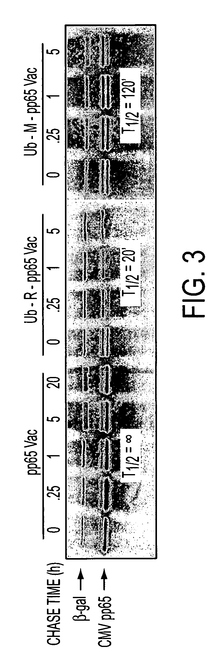 Human cytomegalovirus antigens expressed in MVA and methods of use