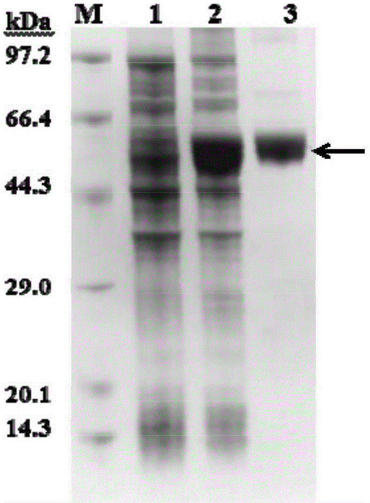 Babesia microti thioredoxin reductase molecule, and gene and applications thereof